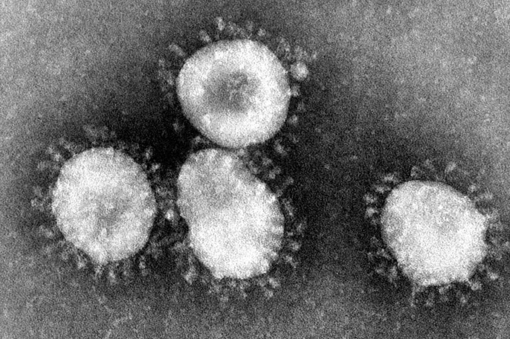 Coronavirus 